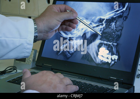 Menschen, Menschen, Menschen (Homo Sapiens sapiens) Arzt eine Röntgenaufnahme des Schädels Stockfoto