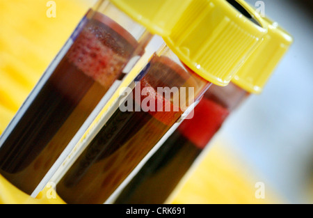 Proben von Blutspenden in Vacutainer Reagenzgläser mit gelben Spitzen. Stockfoto