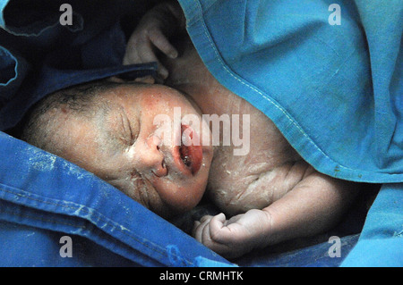 Nahaufnahme des Gesichts eines neugeborenen Babys kurz nach der Geburt. Stockfoto