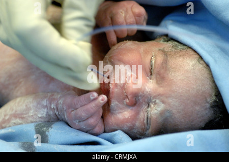 Eine behandschuhte Hand legen eine kleine Absaugung in den Mund eines neugeborenen Kindes, um unerwünschte Schleim aus dem Mund des Kindes zu entfernen. Stockfoto