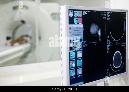 Ein Patient erfährt eine CT (Computertomographie) - Kontrollbildschirm eines CT-Scans (Vordergrund) CT-Scanner mit Patienten (im Hintergrund). Stockfoto