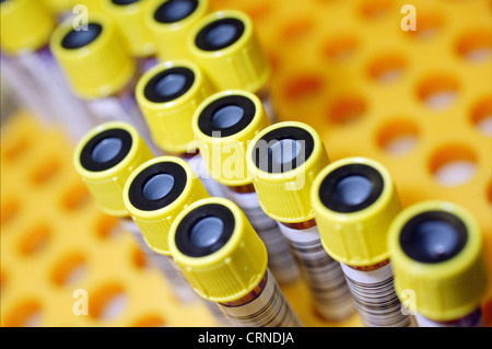 Barcode-Röhren Containg Blutspenden ist jetzt bereit zum testen. Stockfoto