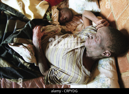 Bettlaegeriger AIDS-Patienten in Matabeleland Stockfoto