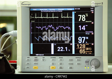 Nahaufnahme von einem Bildschirmgerät Herz Monitor. Stockfoto