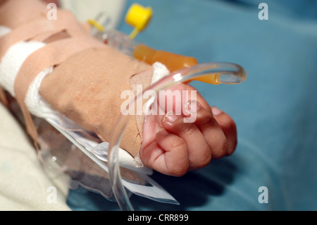 Ein Baby Arm während der Operation. Stockfoto