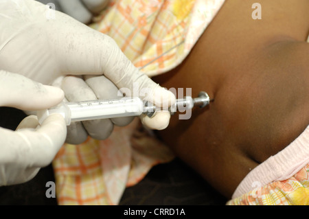 Das Stilett wird innerhalb der Spinalnadel ersetzt, so dass es gefahrlos entfernt werden kann. Stockfoto