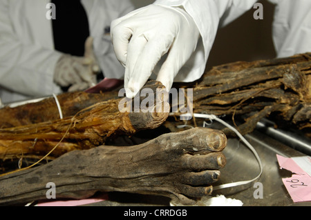 Medizinstudenten untersuchen die Sehnen von der vorderen Seite des Fußes in eine anatomische Probe. Stockfoto