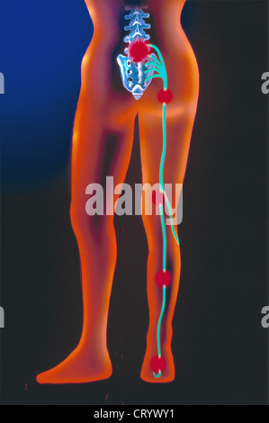 ISCHIAS, ZEICHNUNG Stockfoto