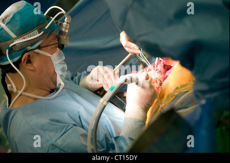 Chirurgen, die Durchführung einer Lebertransplantation am Samsung Medical Centre, South Korea. Stockfoto