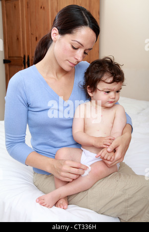 Mama Baby mit Windpocken Creme anwenden Stockfoto