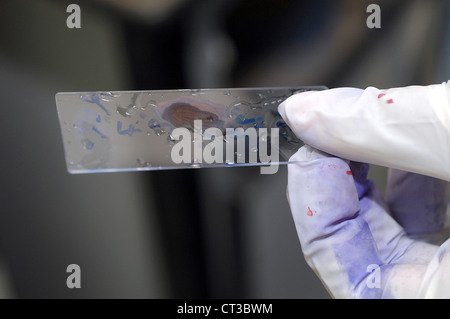 Eine behandschuhte Hand Folie eine Blutprobe. Stockfoto