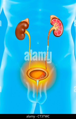 PYELOCYSTITIS, ILLUSTRATION Stockfoto