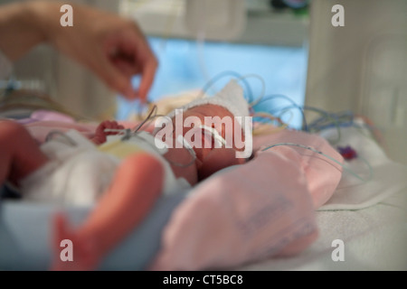 EEG-UNTERSUCHUNG FRÜHGEBURT Stockfoto