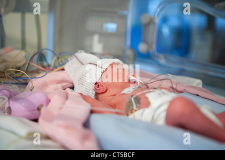 EEG-UNTERSUCHUNG FRÜHGEBURT Stockfoto