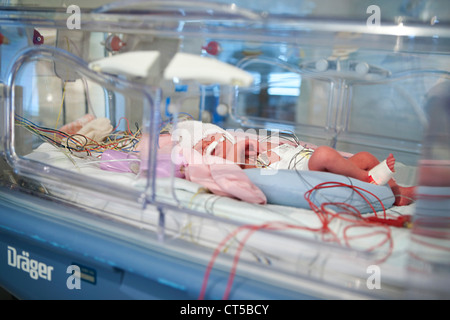 EEG-UNTERSUCHUNG FRÜHGEBURT Stockfoto