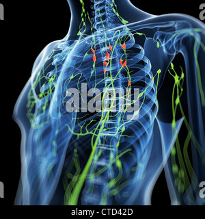 Entzündete Lymphknoten Kunstwerk Stockfoto