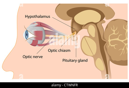Hypophyse (Hirnanhangdrüse) Position relativ zum Sehnerven und Optik Chiasmus Stockfoto