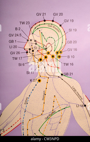 Nahaufnahme von Akupunktur-Diagramm Stockfoto