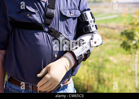 Nahaufnahme Foto zeigt Mann mit Prothese, Schiene auf seinen Arm, um den Heilungsprozess nach der Operation helfen. Stockfoto