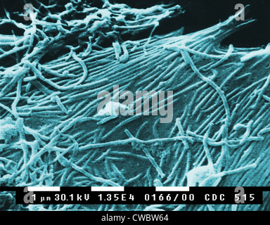 Ebola-Virionen (Viruspartikel). Ebola hämorrhagisches Fieber ist eine schwere, oft tödliche Erkrankung bei Menschen, Affen, Gorillas, und Stockfoto