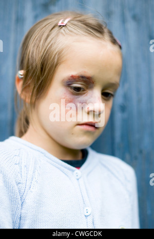 Berlin, Gewalt in der Familie (gestellte Szene, Verletzungen entstanden sind!) Stockfoto