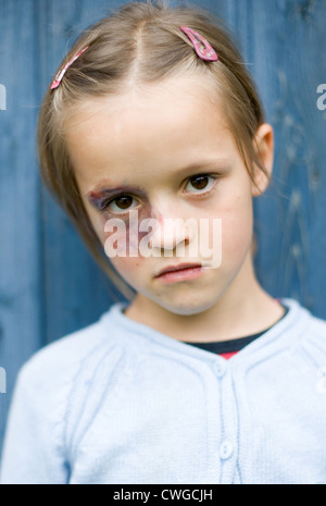 Berlin, Gewalt in der Familie (gestellte Szene, Verletzungen entstanden sind!) Stockfoto