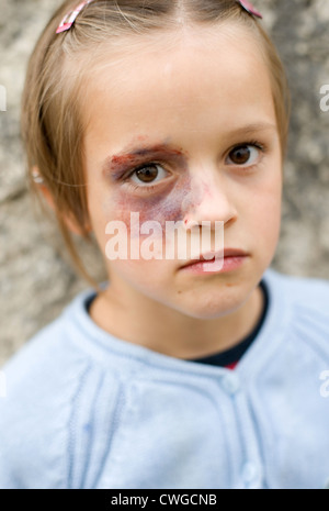 Berlin, Gewalt in der Familie (gestellte Szene, Verletzungen entstanden sind!) Stockfoto