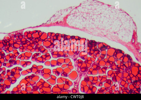 medizinische Anthropotomy Physiologie mikroskopische Wissenschaftsabschnitt der Schilddrüse Hintergrund Stockfoto