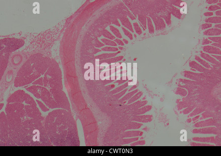 medizinische Anthropotomy Physiologie mikroskopische Wissenschaftsabschnitt der kleinen Intestinum Tenue Gewebe Stockfoto