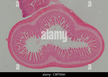 medizinische Anthropotomy Physiologie mikroskopische Wissenschaftsabschnitt der kleinen Intestinum Tenue Gewebe Stockfoto