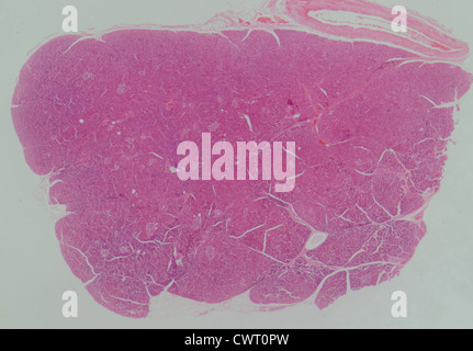 medizinische Anthropotomy Physiologie mikroskopische Wissenschaftsabschnitt des Pankreas-Gewebe Stockfoto