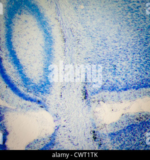 Wissenschaft medizinische Mikroskopie Schliffbild, Ratte Gehirn hippocampal Neuronen Stockfoto