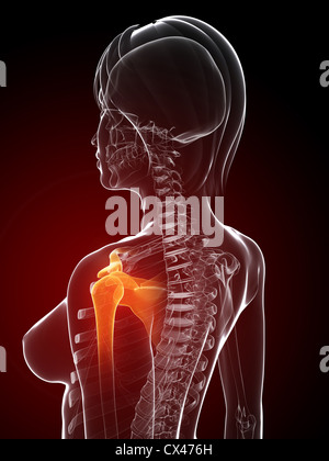 3D gerenderten Anatomie-Illustration - schmerzende Schulter Stockfoto