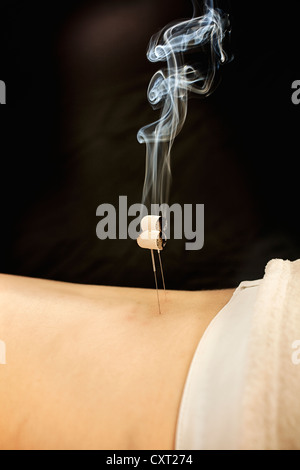 Moxa-Therapie, Moxibustion, traditionelle chinesische Medizin Stockfoto