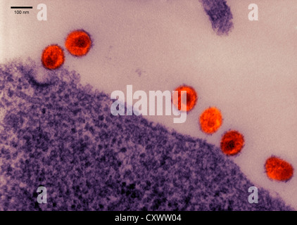 Transmission Electron Schliffbild von HIV Stockfoto