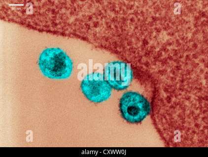 Transmission Electron Schliffbild von HIV Stockfoto