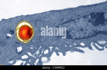 Transmission Electron Schliffbild von Staphylococcus Stockfoto