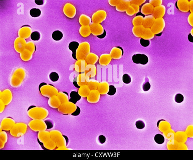 SEM von Gram-positiven Enterococcus Bakterien Stockfoto