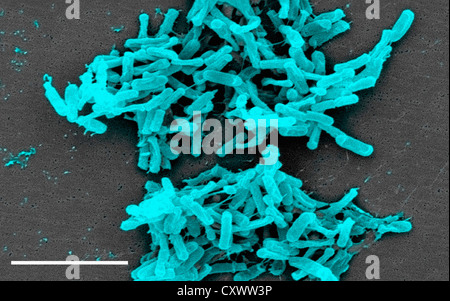 SEM von Clostridium Difficile Bakterien Stockfoto