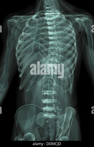 Röntgenbild zeigt den Brustkorb und Becken Stockfotografie - Alamy