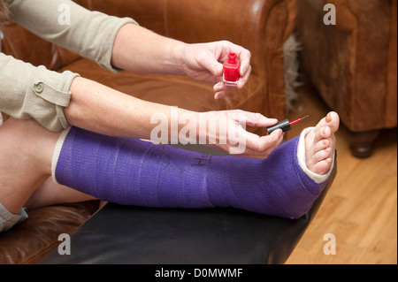 Frau mit gebrochenen Knöchel malen ihre Fußnägel mit rotem Nagellack Stockfoto