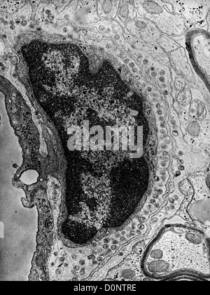 Dieser negativ gefärbten Transmission Electron Schliffbild (TEM) zeigte Präsenz zahlreiche intrazelluläre Gruppe C RNA Tumor virus Stockfoto