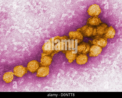 Ein Elektron Schliffbild West-Nil-Virus. West-Nil-Virus ist Flavivirus in Afrika, Westasien Naher Osten weit verbreitet. Es ist Stockfoto