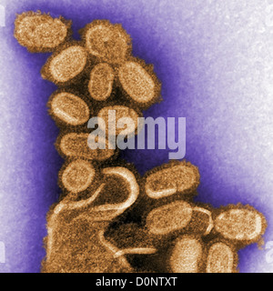 Dieser negativ gefärbten Transmission Electron Schliffbild (TEM) zeigt nachgebildeten 1918 Grippe Virionen, die gesammelt wurden Stockfoto