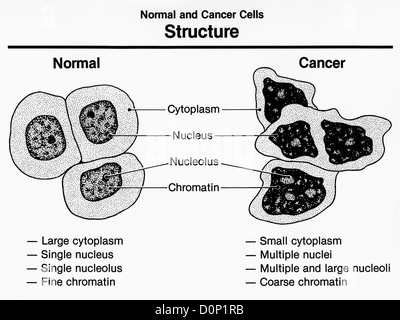 Eine künstlerische Interpretation Struktur normalen Zellen Krebszellen zeigt beide Merkmale. Krebszellen Exhibt erhöht, sondern Stockfoto