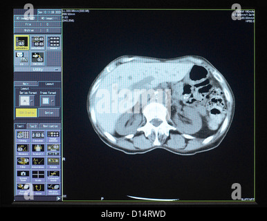 Gehirn-Scan Bild Stockfoto