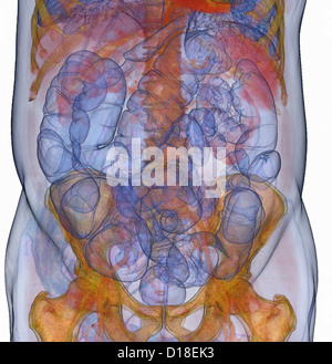 3D CT-Scan, Koloskopie, virtuelle Koloskopie Stockfoto