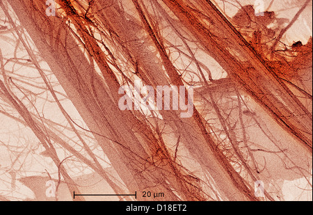 Scanning Electron Schliffbild von Asbest, 1200 x Stockfoto