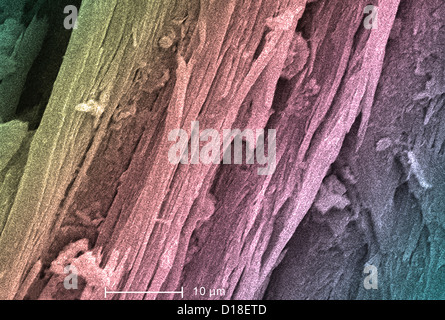 Scanning Electron Schliffbild von Asbest, 2000 x Stockfoto