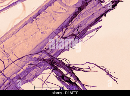 Scanning Electron Schliffbild von Asbest Stockfoto